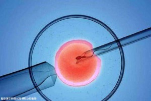 关于代生包成功代妈补偿